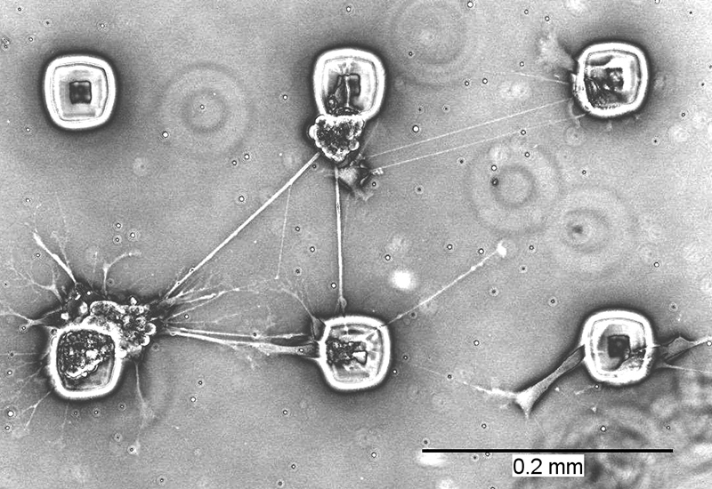 Neuronales Zellwachstum