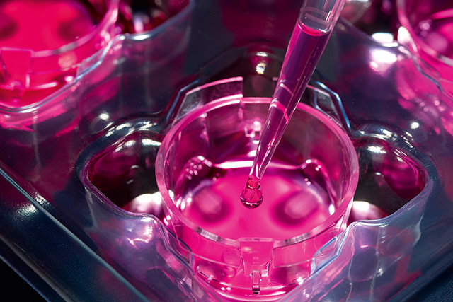 MEV132038 Zellbiologie, Entnahme einer zellbiologischen Probe