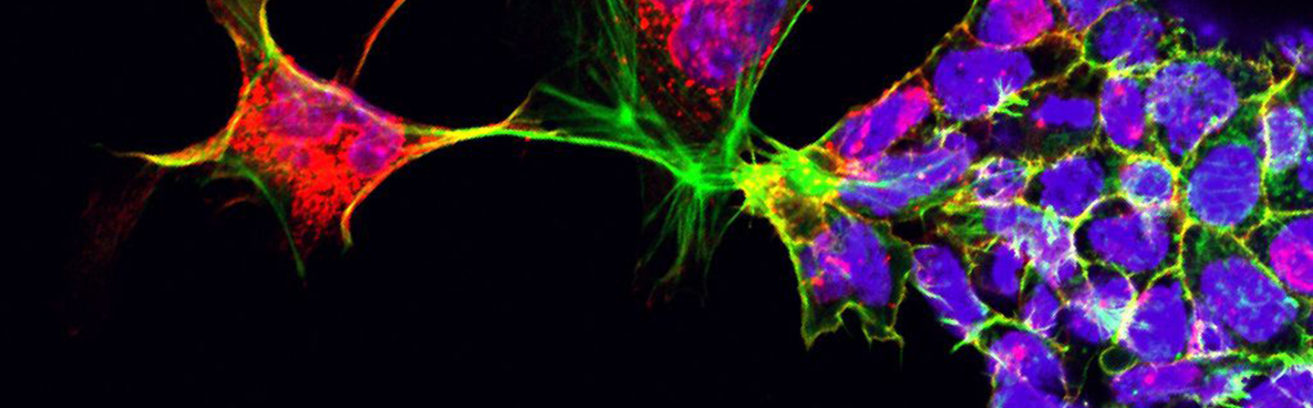 Konfokalmikroskopische Aufnahme einer Immunfluoreszenzfärbung von Stammzellen