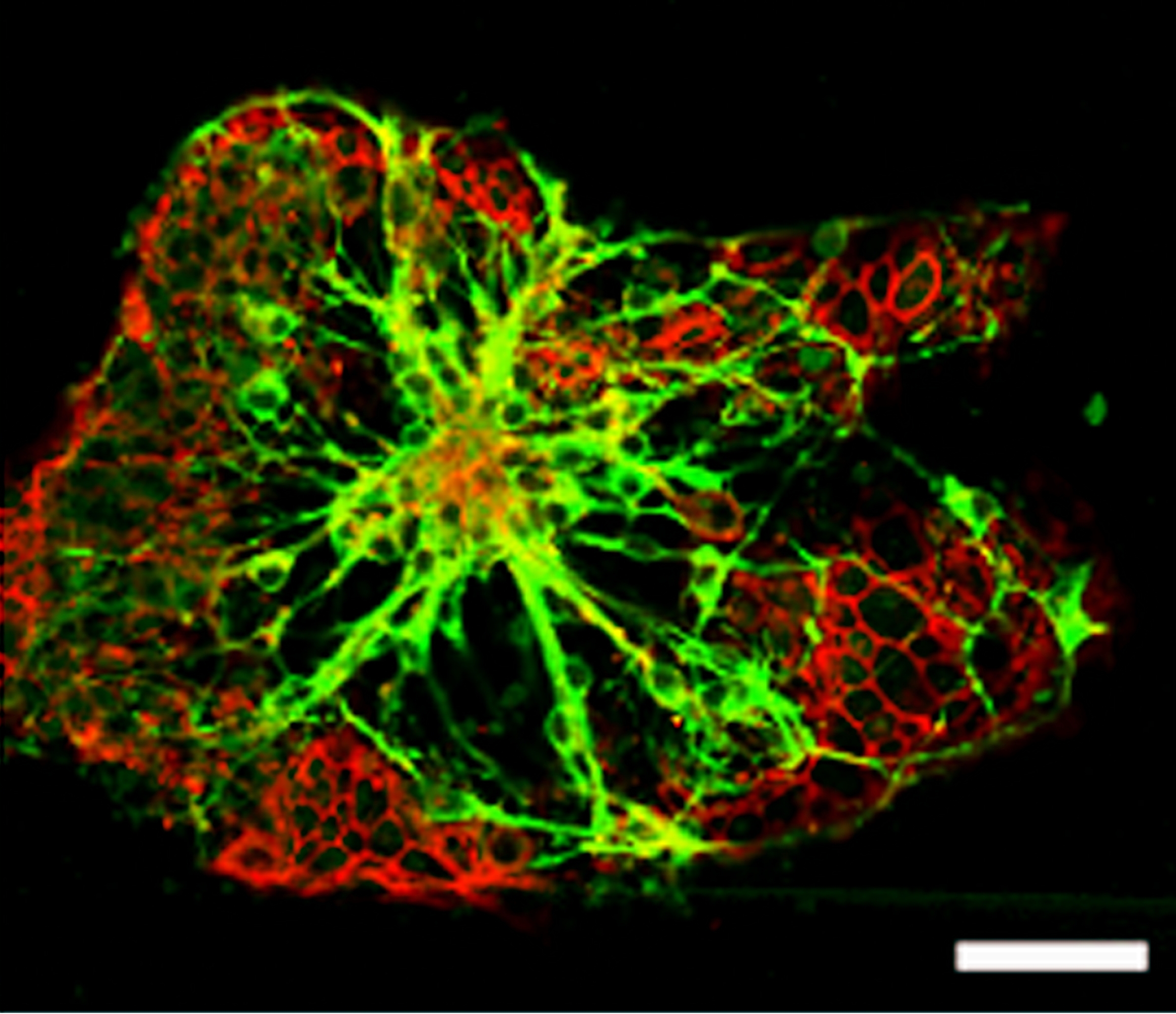 stem cells