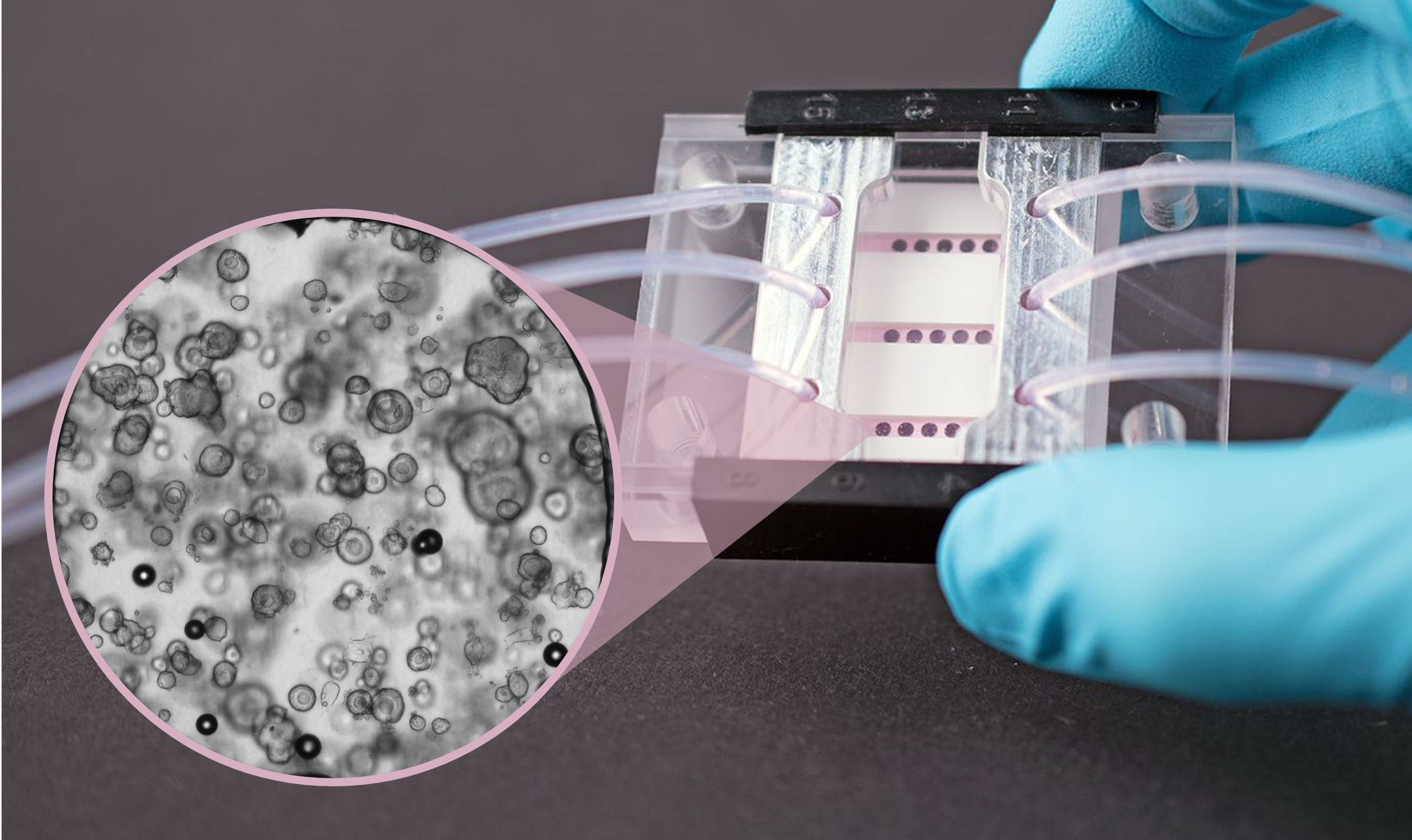 Colon carcinoma organoid-on-chip