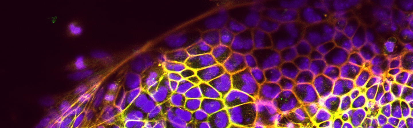 Immunfluoreszenzfärbung zum Nachweis der Stammzelldifferenzierung zu Herzmuskelzellen.